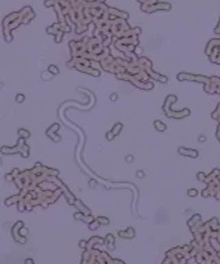 Microfilaria Image1