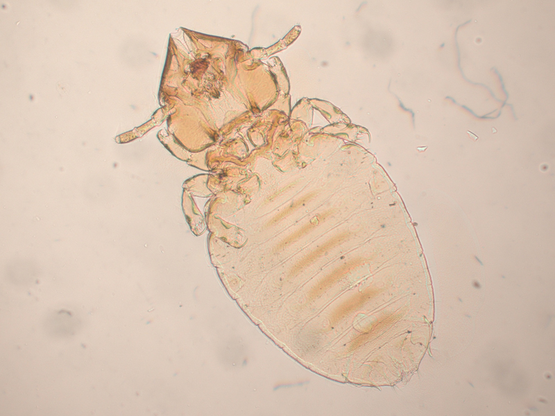 Власоеды у кошек. Власоед клещ под микроскопом.