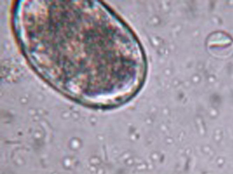 giardia cyst in fecal float