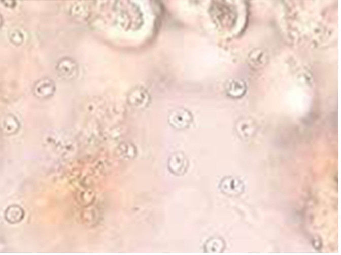 Oocysts of cryptosporidium from fecal flotation