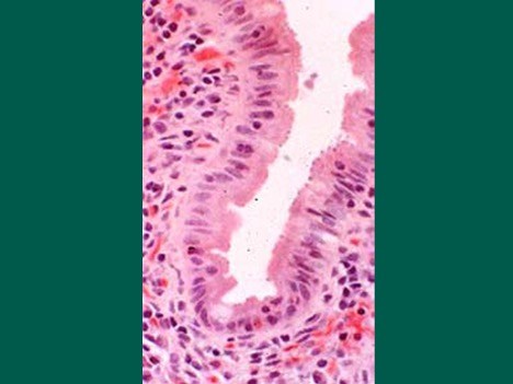 Photomicrograph of developmental stages of Cryptosporidium from the small intestine