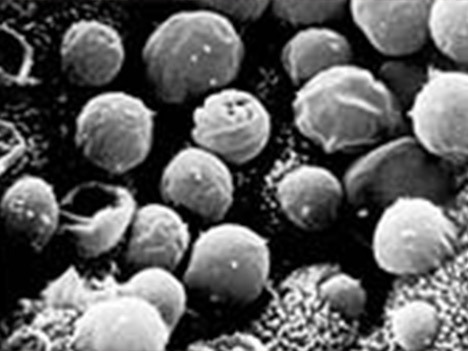 Scanning electron microscopy showing Cryptosporidium stages in the microvillus border of epithelial cells